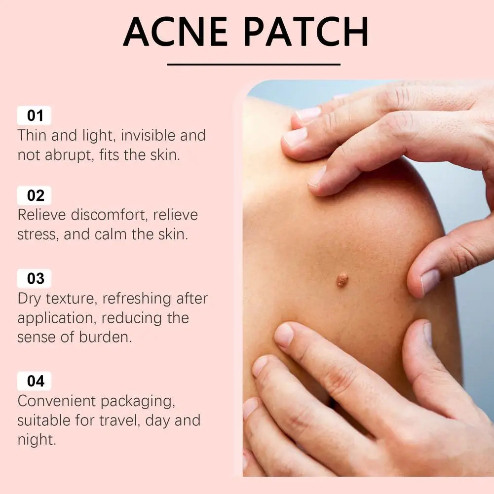 144PCs Face Patches For Pimples Microneedles Drying Patch Blemish Covering Stickers Invisible Spot Care Beauty Face Care Tool