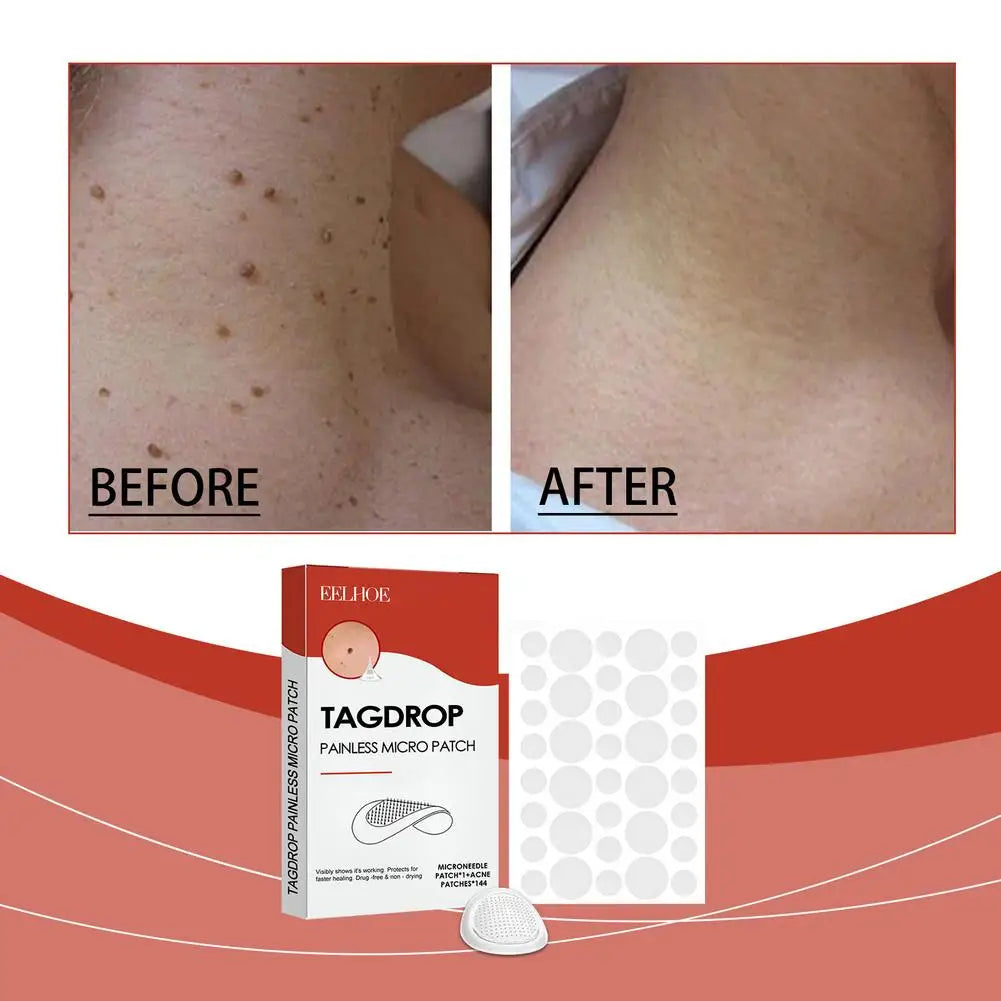 144PCs Face Patches For Pimples Microneedles Drying Patch Blemish Covering Stickers Invisible Spot Care Beauty Face Care Tool