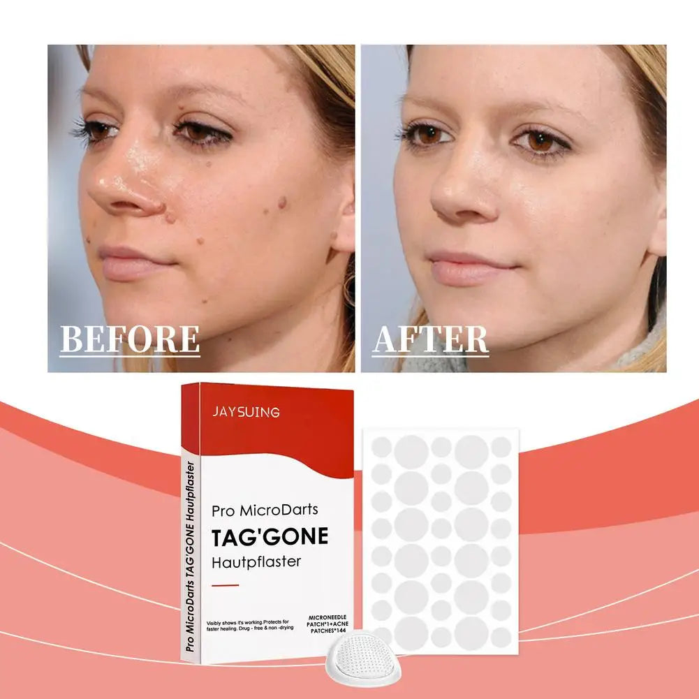 144PCs Face Patches For Pimples Microneedles Drying Patch Blemish Covering Stickers Invisible Spot Care Beauty Face Care Tool